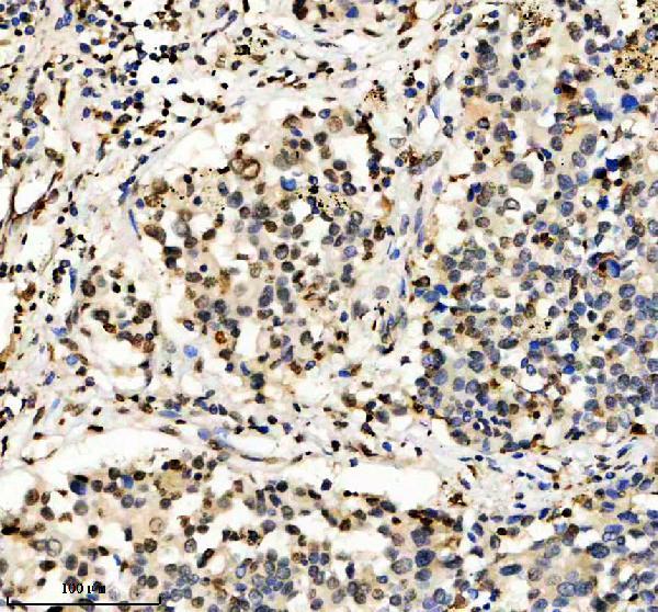 a14943 1 h2aj primary antibodies ihc testing 2