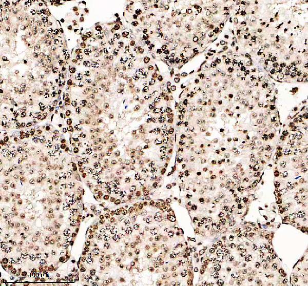 a14943 1 h2aj primary antibodies ihc testing 3