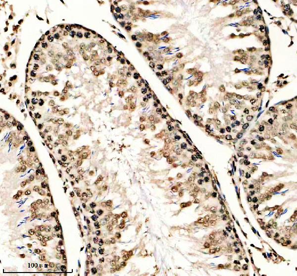 a14943 1 h2aj primary antibodies ihc testing 4