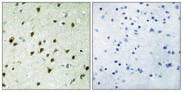 a14953 mxd4 primary antibodies ihc testing 1