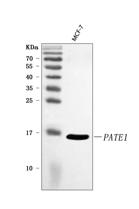  Western blot analysis of PATE1 using anti-PATE1 antibody (A14959)