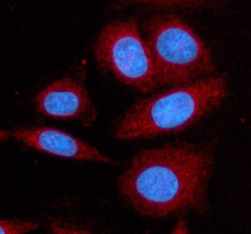 IF analysis of KLHL24 using anti-KLHL24 antibody (A14963-1)