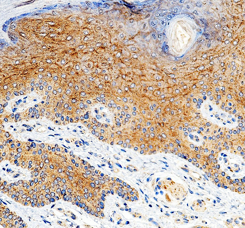 IHC analysis of KLHL24 using anti-KLHL24 antibody (A14963-1)