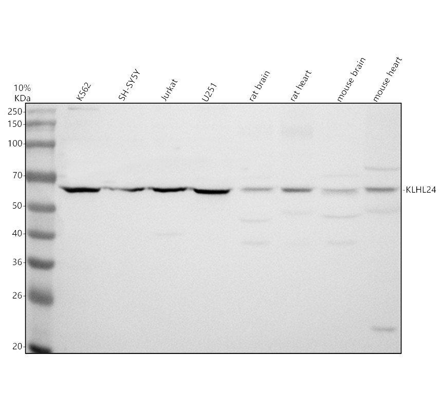 Western blot analysis of KLHL24 using anti-KLHL24 antibody (A14963-1)