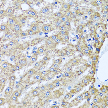 Immunohistochemistry of paraffin-embedded human liver using TMEM189 antibody at dilution of 1:100 (40x lens)