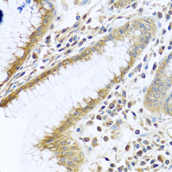 Immunohistochemistry of paraffin-embedded human stomach using TMEM189 antibody at dilution of 1:100 (40x lens)