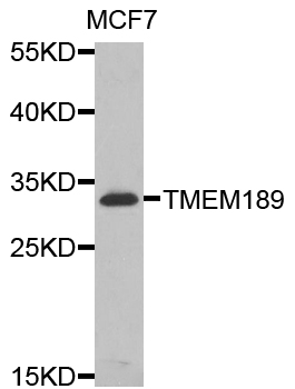 Western blot analysis of extracts of MCF7 cells, using TMEM189 antibody