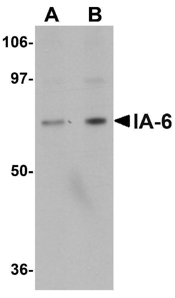 Western blot analysis of IA-6 in rat thymus tissue lysate with IA-6 antibody at (A) 1 and (B) 2 μg/mL