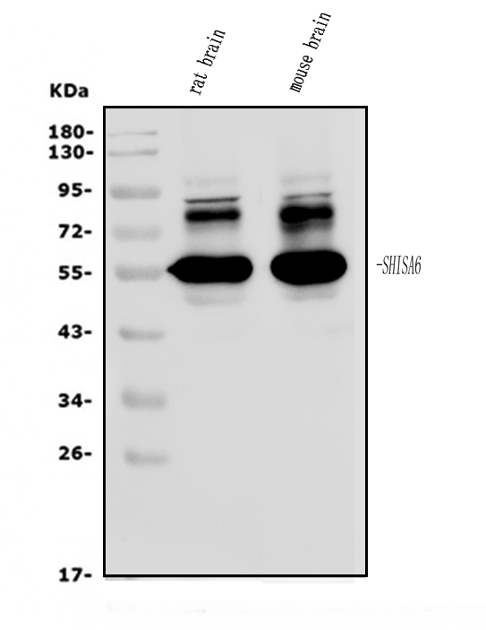  Western blot analysis of SHISA6 using anti-SHISA6 antibody (A14975-1)