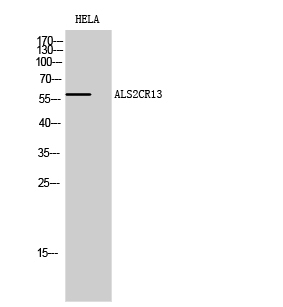 Western Blot analysis of HELA cells using ALS2CR13 Polyclonal Antibody diluted at 1:500