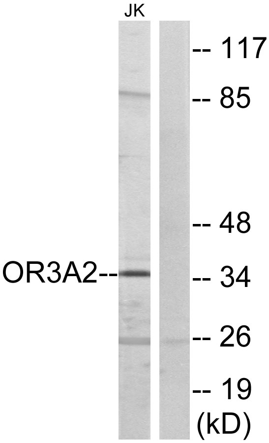 Western blot analysis of lysates from Jurkat cells, using OR3A2 Antibody