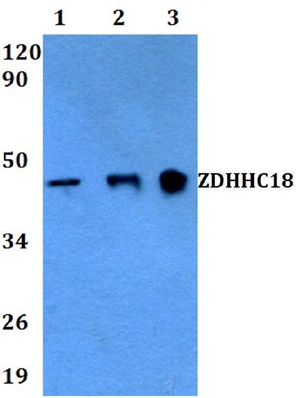 a15025 zdhhc18 primary antiboties wb testing 1
