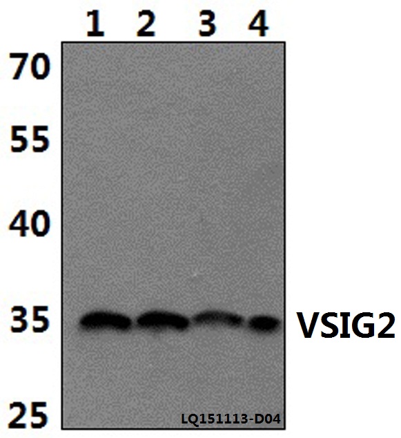 a15033 1 vsig2 primary antiboties wb testing 1