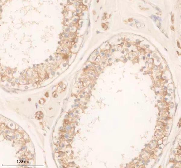 a15035 2 slc22a14 primary antibodies ihc testing 1