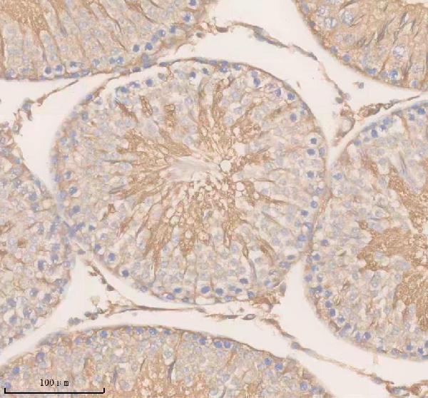 a15035 2 slc22a14 primary antibodies ihc testing 2