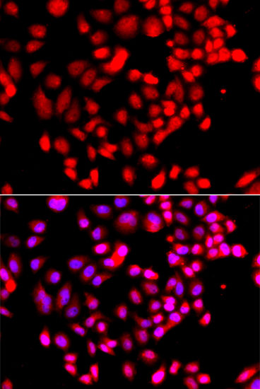 a15036 rps6kl1 primary antiboties if testing 2