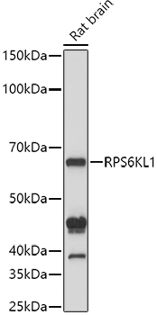 a15036 rps6kl1 primary antiboties wb testing 1