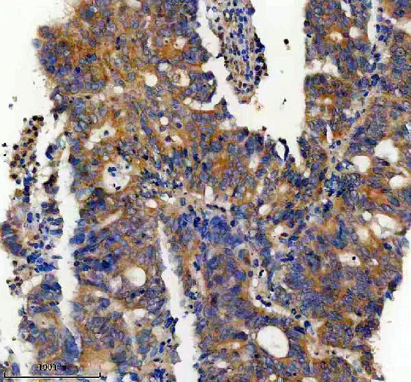 a15043 dctn6 primary antibodies ihc testing 1