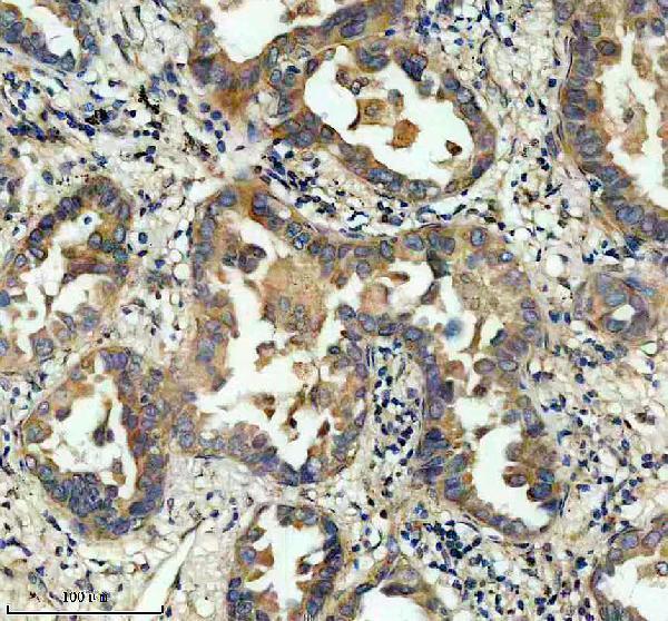 a15043 dctn6 primary antibodies ihc testing 2
