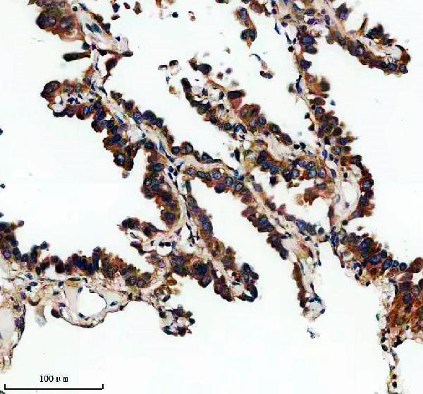 a15043 dctn6 primary antibodies ihc testing 3