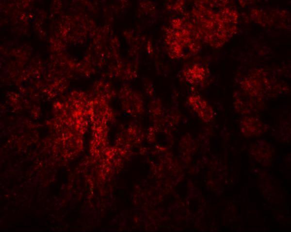 Immunofluorescence of CCDC106 in rat brain tissue with CCDC106 antibody at 20 μg/mL