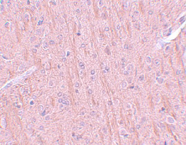 Immunohistochemistry of CCDC106 in rat brain tissue with CCDC106 antibody at 5 μg/mL