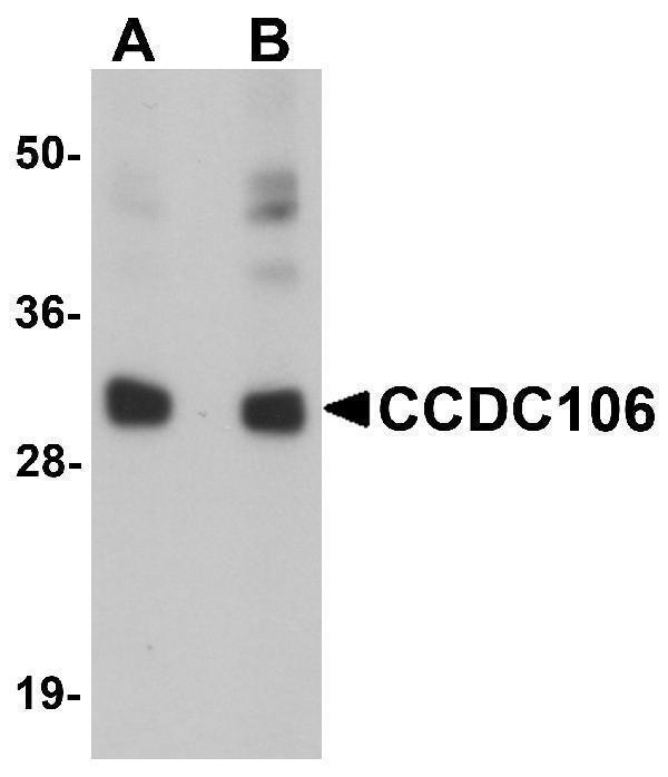 Western blot analysis of CCDC106 in human brain tissue lysate with CCDC106 antibody at (A) 0