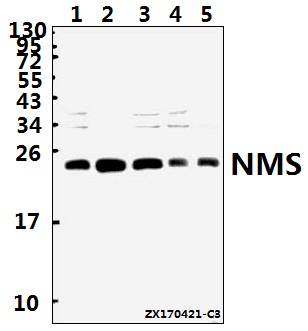 Western blot (WB) analysis of NMS polyclonal antibody at 1:500 dilution
Lane1:Hela whole cell lysate(40ug)
Lane2:HCT116 whole cell lysate(40ug)
Lane3:A549 whole cell lysate(40ug)
Lane4:PC12 whole cell lysate(40ug)
Lane5:CT26 whole cell lysate(40ug)
