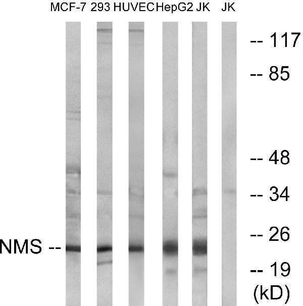 Western blot analysis of lysates from Jurkat, HepG2, HUVEC, 293, and MCF-7 cells, using NMS Antibody
