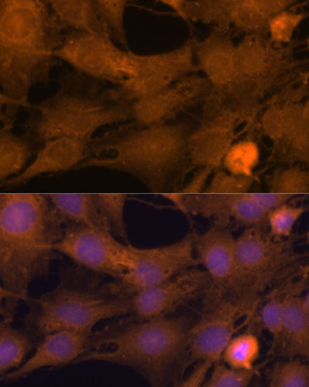 a15075 zc3h7a primary antiboties if testing 2