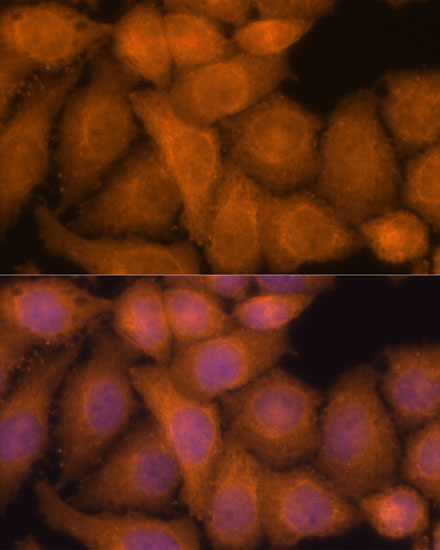 a15075 zc3h7a primary antiboties if testing 3