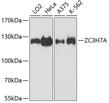 a15075 zc3h7a primary antiboties wb testing 1
