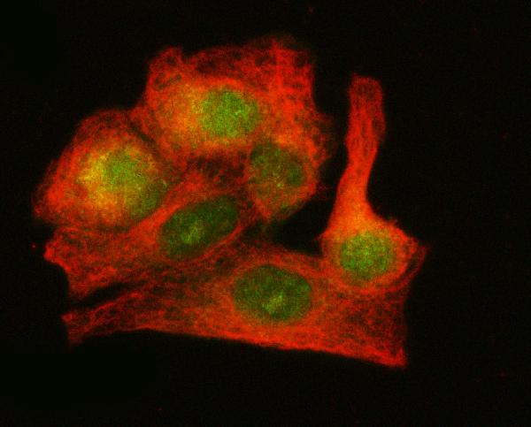 Figure 5. IF analysis of LZIC using anti-LZIC antibody (A15087) and anti-Beta Tubulin antibody (M01857-3). LZIC was detected in immunocytochemical section of A549 cell. Enzyme antigen retrieval was performed using IHC enzyme antigen retrieval reagent (AR0022) for 15 mins. The cells were blocked with 10% goat serum. And then incubated with 5 microg/mL rabbit anti-LZIC Antibody (A15087) and mouse anti-Beta Tubulin antibody (M01857-3) overnight at 4°C. DyLight®488 Conjugated Goat Anti-Rabbit IgG (BA1127) and Cy3 Conjugated Goat Anti-Mouse IgG (BA1031) were used as secondary antibody at 1:500 dilution and incubated for 30 minutes at 37°C. Visualize using a fluorescence microscope and filter sets appropriate for the label used. Figure 5. IF analysis of LZIC using anti-LZIC antibody (A15087) and anti-Beta Tubulin antibody (M01857-3). LZIC was detected in immunocytochemical section of A549 cell. Enzyme antigen retrieval was performed using IHC enzyme antigen retrieval reagent (AR0022) for 15 mins. The cells were blocked with 10% goat serum. And then incubated with 5 microg/mL rabbit anti-LZIC Antibody (A15087) and mouse anti-Beta Tubulin antibody (M01857-3) overnight at 4°C. DyLight®488 Conjugated Goat Anti-Rabbit IgG (BA1127) and Cy3 Conjugated Goat Anti-Mouse IgG (BA1031) were used as secondary antibody at 1:500 dilution and incubated for 30 minutes at 37°C. Visualize using a fluorescence microscope and filter sets appropriate for the label used.