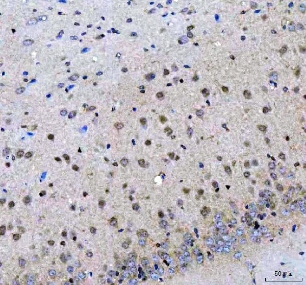 Figure 3. IHC analysis of LZIC using anti-LZIC antibody (A15087). LZIC was detected in a paraffin-embedded section of mouse brain tissue. Heat mediated antigen retrieval was performed in EDTA buffer (pH 8.0, epitope retrieval solution). The tissue section was blocked with 10% goat serum. The tissue section was then incubated with 2 microg/ml rabbit anti-LZIC Antibody (A15087) overnight at 4°C. Peroxidase Conjugated Goat Anti-rabbit IgG was used as secondary antibody and incubated for 30 minutes at 37°C. The tissue section was developed using HRP Conjugated Rabbit IgG Super Vision Assay Kit (Catalog # SV0002) with DAB as the chromogen. Figure 3. IHC analysis of LZIC using anti-LZIC antibody (A15087). LZIC was detected in a paraffin-embedded section of mouse brain tissue. Heat mediated antigen retrieval was performed in EDTA buffer (pH 8.0, epitope retrieval solution). The tissue section was blocked with 10% goat serum. The tissue section was then incubated with 2 microg/ml rabbit anti-LZIC Antibody (A15087) overnight at 4°C. Peroxidase Conjugated Goat Anti-rabbit IgG was used as secondary antibody and incubated for 30 minutes at 37°C. The tissue section was developed using HRP Conjugated Rabbit IgG Super Vision Assay Kit (Catalog # SV0002) with DAB as the chromogen.