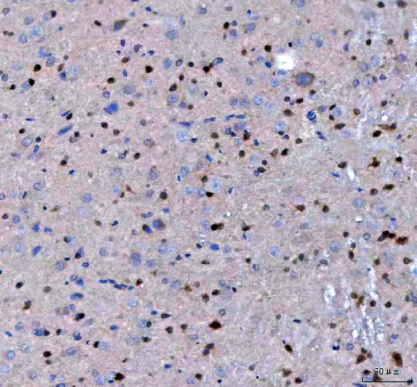Figure 4. IHC analysis of LZIC using anti-LZIC antibody (A15087). LZIC was detected in a paraffin-embedded section of rat brain tissue. Heat mediated antigen retrieval was performed in EDTA buffer (pH 8.0, epitope retrieval solution). The tissue section was blocked with 10% goat serum. The tissue section was then incubated with 2 microg/ml rabbit anti-LZIC Antibody (A15087) overnight at 4°C. Peroxidase Conjugated Goat Anti-rabbit IgG was used as secondary antibody and incubated for 30 minutes at 37°C. The tissue section was developed using HRP Conjugated Rabbit IgG Super Vision Assay Kit (Catalog # SV0002) with DAB as the chromogen. Figure 4. IHC analysis of LZIC using anti-LZIC antibody (A15087). LZIC was detected in a paraffin-embedded section of rat brain tissue. Heat mediated antigen retrieval was performed in EDTA buffer (pH 8.0, epitope retrieval solution). The tissue section was blocked with 10% goat serum. The tissue section was then incubated with 2 microg/ml rabbit anti-LZIC Antibody (A15087) overnight at 4°C. Peroxidase Conjugated Goat Anti-rabbit IgG was used as secondary antibody and incubated for 30 minutes at 37°C. The tissue section was developed using HRP Conjugated Rabbit IgG Super Vision Assay Kit (Catalog # SV0002) with DAB as the chromogen.
