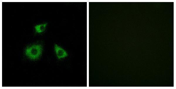 a15101 mrpl52 primary antibodies if testing 1