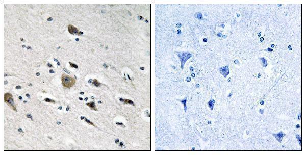 a15101 mrpl52 primary antibodies ihc testing 2