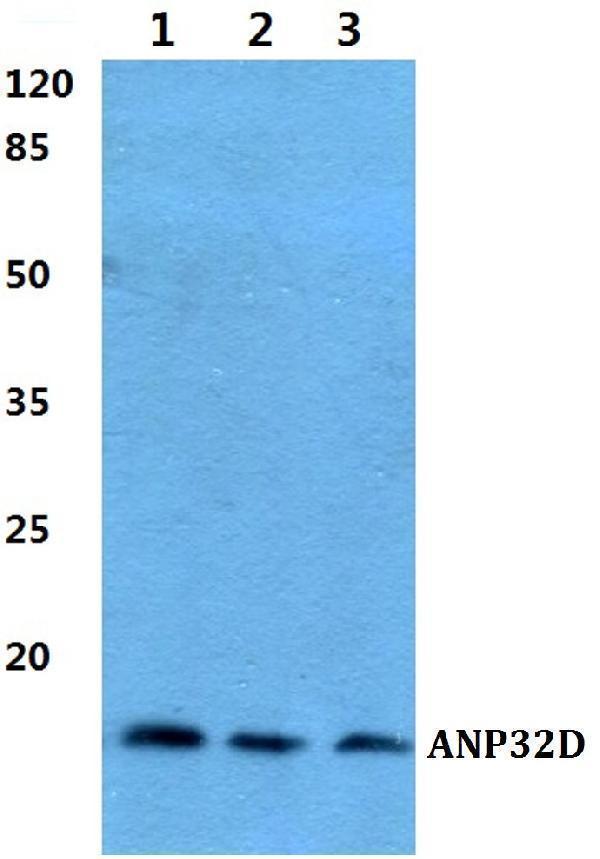 Western blot (WB) analysis of ANP32D polyclonal antibody at 1:500 dilution
Lane1:Hela whole cell lysate
Lane2:Mouse liver tissue lysate
Lane3:Rat iver tissue lysate