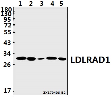 Western blot (WB) analysis of LDLRAD1 polyclonal antibody at 1:500 dilution
Lane1:Jurkat whole cell lysate(40ug)
Lane2:A549 whole cell lysate(40ug)
Lane3:Panc1 whole cell lysate(40ug)
Lane4:MEF whole cell lysate(40ug)
Lane5:PC12 whole cell lysate(40ug)