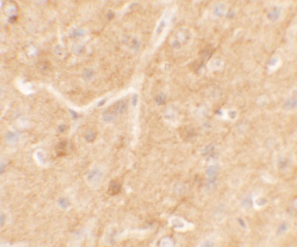 a15117 trim51 primary antibodies ihc testing 2