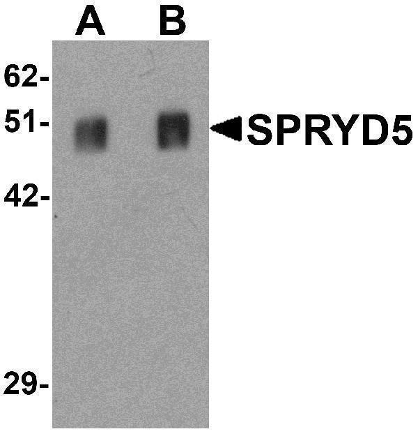 a15117 trim51 primary antibodies wb testing 1