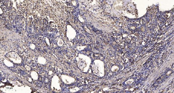 a15122 arhgap23 primary antibodies ihc testing 1