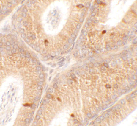 a15127 spata4 primary antibodies ihc testing 2