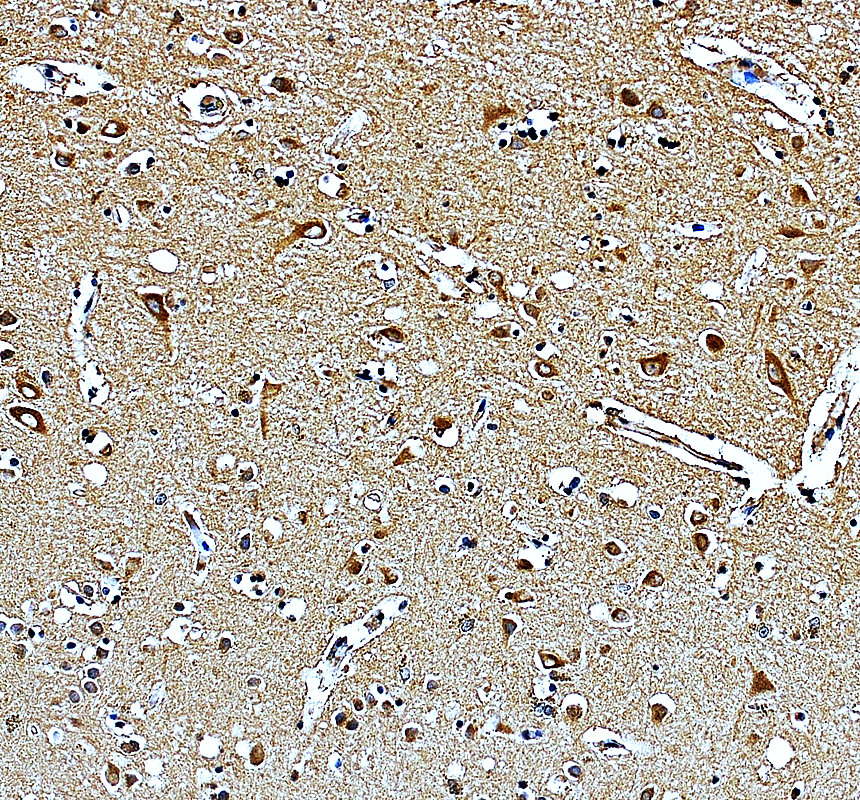 a15134 2 mrpl17 primary antibodies ihc testing 1