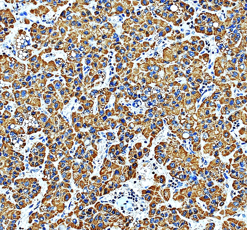 a15134 2 mrpl17 primary antibodies ihc testing 2