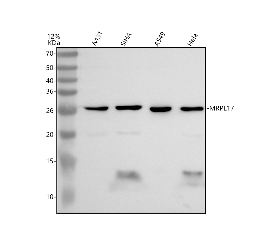a15134 2 mrpl17 primary antibodies wb testing 1