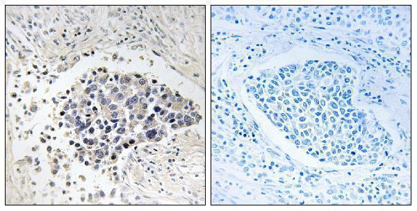 a15136 2 cpne8 primary antibodies ihc testing 1