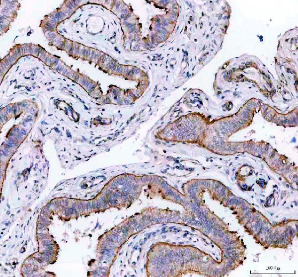 IHC analysis of DNAJB13 using anti-DNAJB13 antibody (A15137)