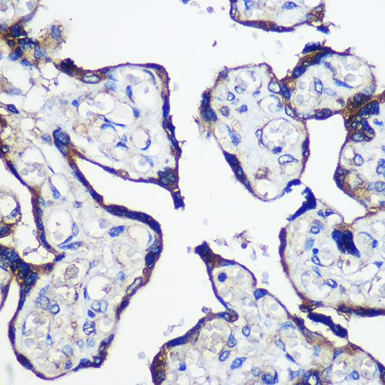 Immunohistochemistry of paraffin-embedded Human placenta using PARP8 Rabbit pAb  at dilution of 1:100 