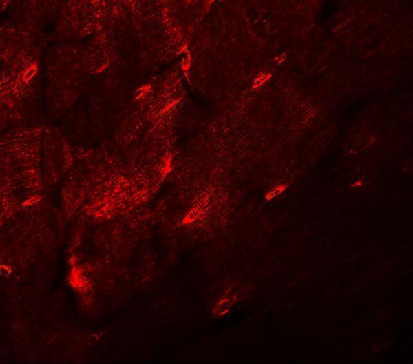 Immunofluorescence of TMEM38A in mouse skeletal muscle tissue with TMEM38A antibody at 20 μg/mL